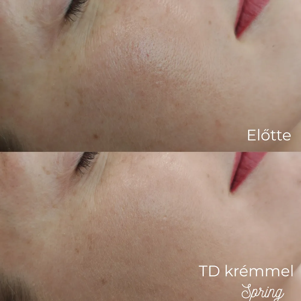 Arcbőr közelről a TD Cream Spring felvitele előtt és után